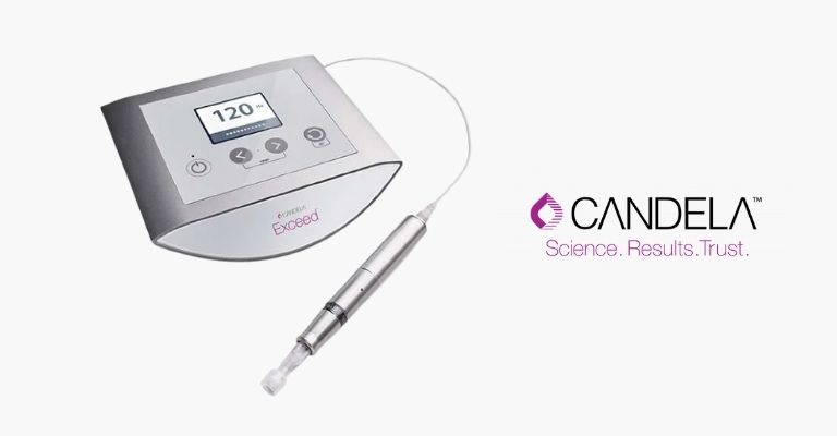 candela laser